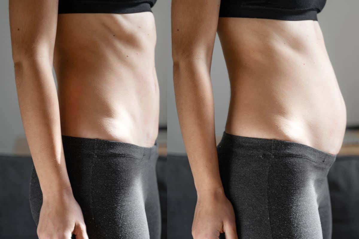 How long does diastasis recti take to improve Cockfosters?