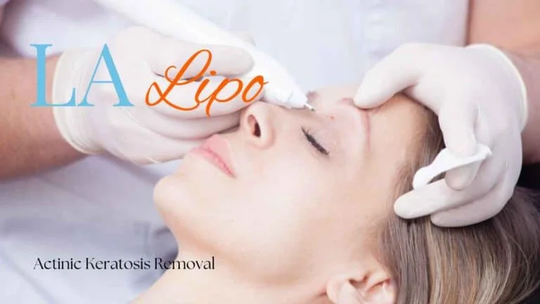 Woman receiving Actinic Keratosis Removal Treatment Cockfosters