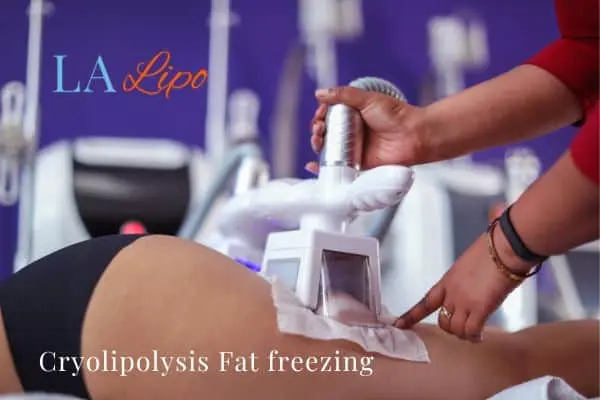women getting fat freezing Cockfosters