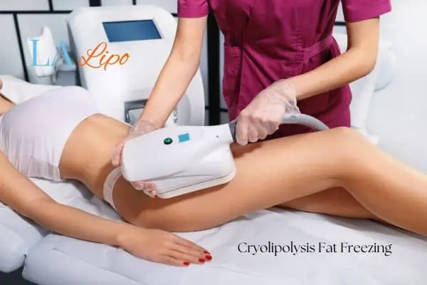 Woman receiving coolsculpting Cockfosters treatment on her thighs