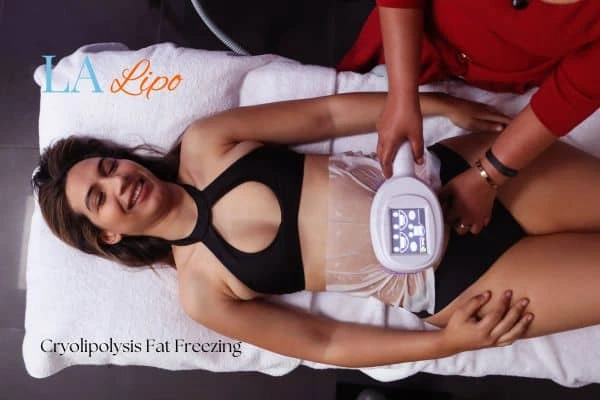 woman getting cryolipolysis Cockfosters