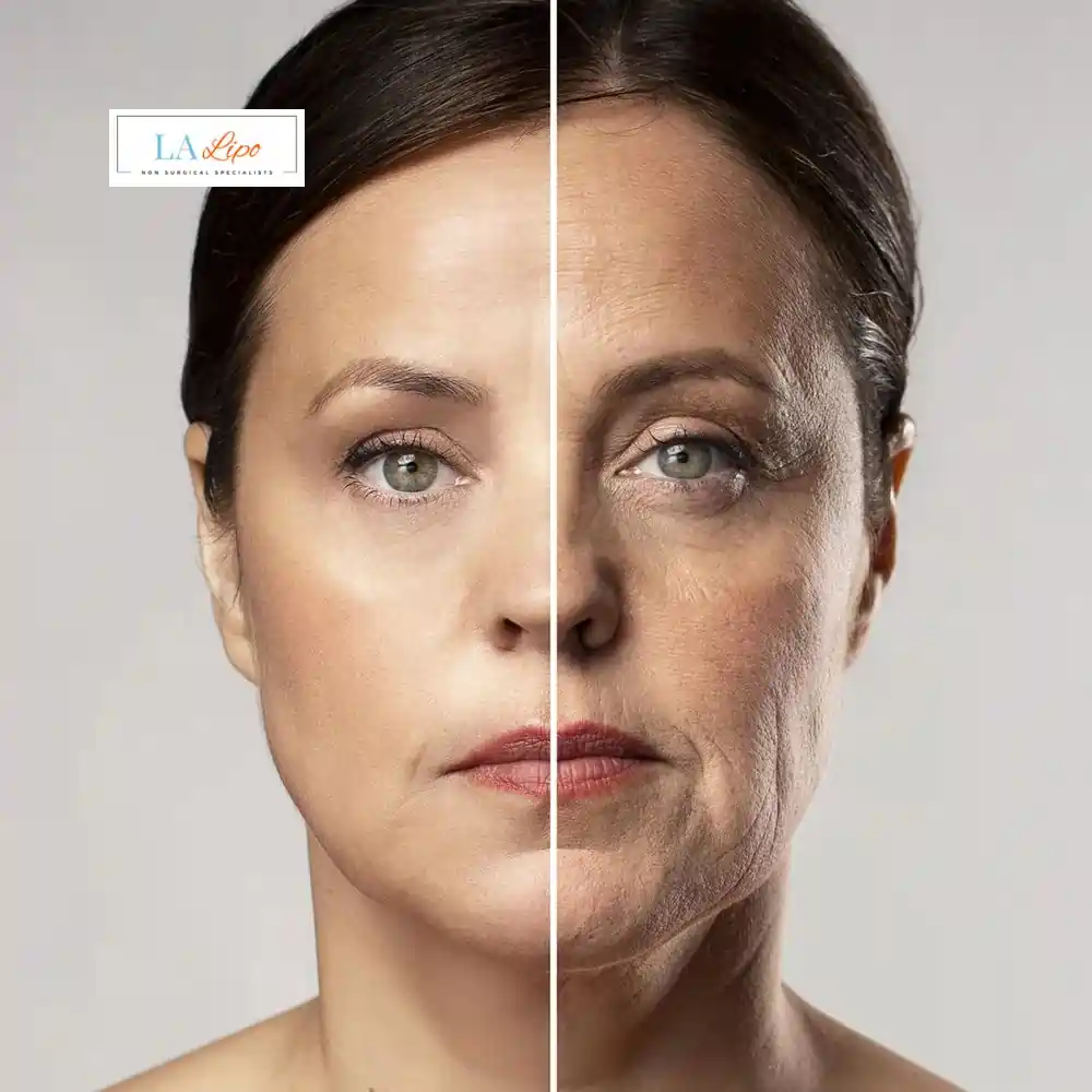 How Can You Tell If Non-Surgical Skin Tightening Is Right for You Cockfosters?