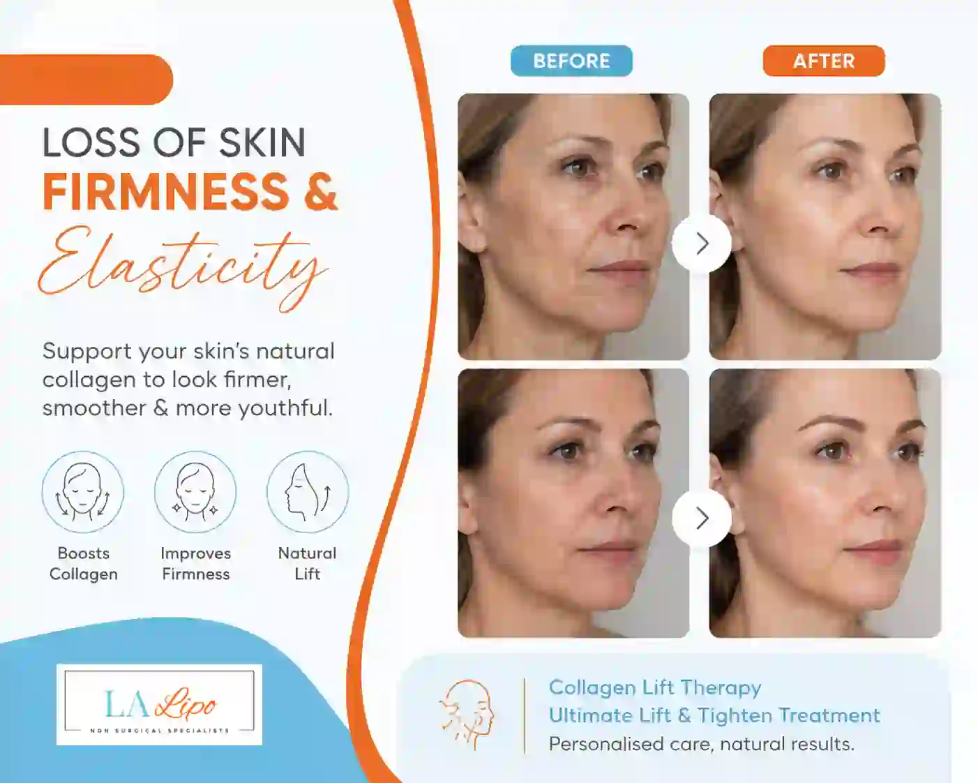 Sign #7: Loss of Skin Firmness and Elasticity Cockfosters