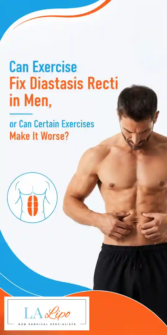 Can Exercise Fix Diastasis Recti in Men, or Can Certain Exercises Make It Worse Cockfosters?